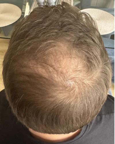 James — before